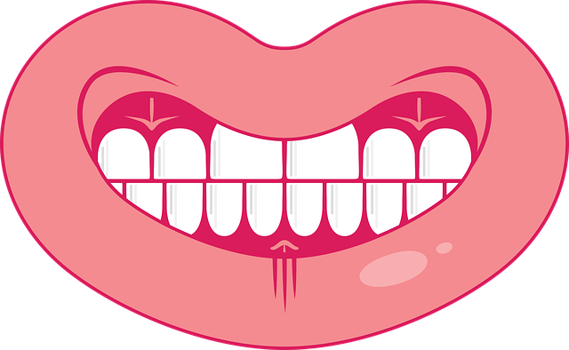 Le lien entre le détartrage dentaire et les maladies des gencives